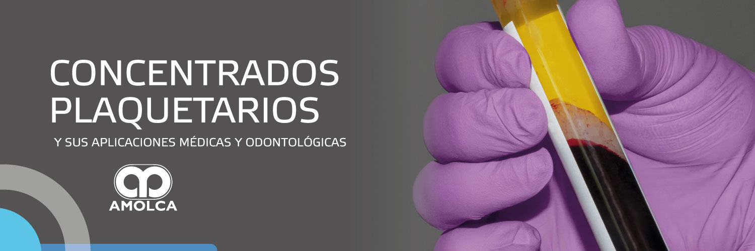 Concentrados plaquetarios y sus aplicaciones médicas y odontológicas Concentrados plaquetarios y sus aplicaciones médicas y odontológicas