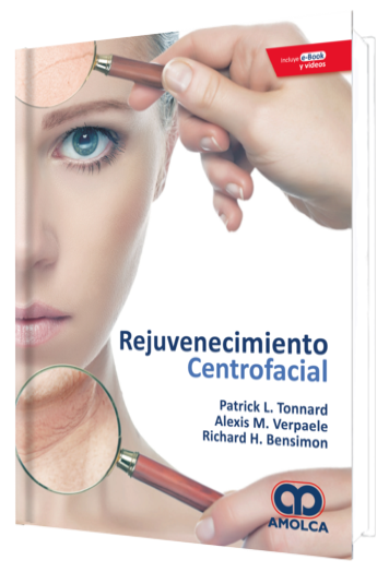Rejuvenecimiento Centrofacial