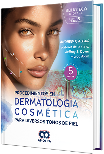 Procedimientos en Dermatología Cosmética para diversos tonos de piel