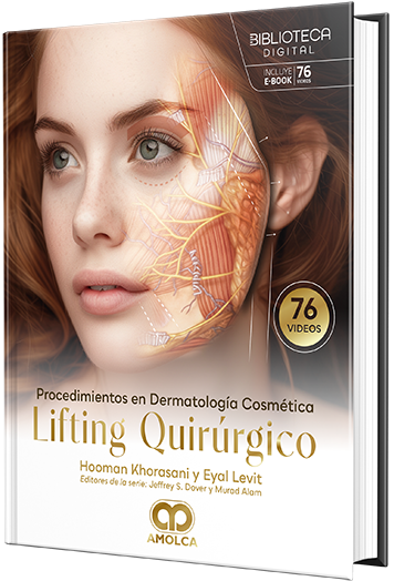 Procedimientos en dermatología cosmética. Lifting quirúrgico