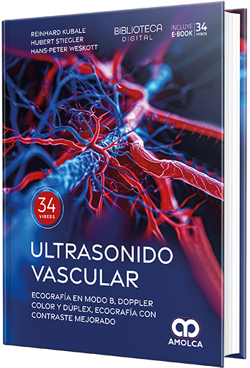 Ultrasonido vascular. Ecografía en Modo B, Doppler color y dúplex, ecografía con contraste mejorado