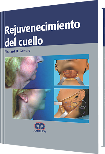 Rejuvenecimiento del Cuello