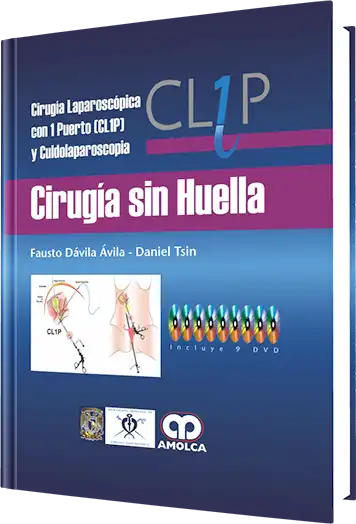 Cirugía sin Huella