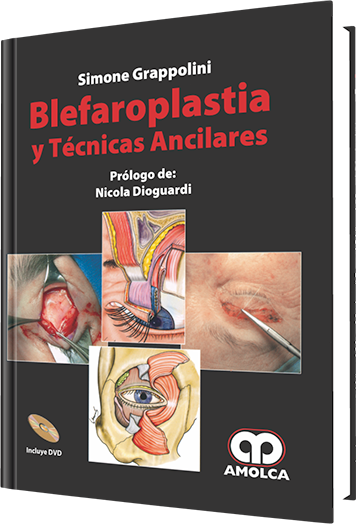 Blefaroplastia y Técnicas Ancilares