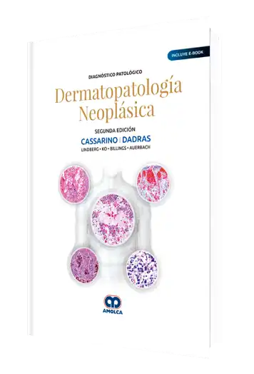 Diagnóstico Patológico Dermatopatología Neoplásica 2 Edición