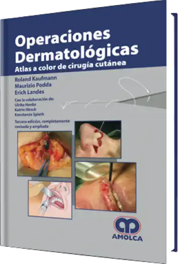 Operaciones Dermatológicas. Atlas a Color de Cirugía Cutánea 3 Edición