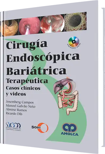 Cirugía Endoscópica Bariátrica Terapéutica