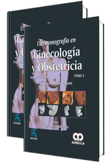 Ultrasonografía en Ginecología y Obstetricia 2 Edición