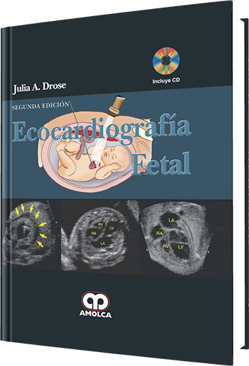 Ecocardiografía Fetal 2 Edición