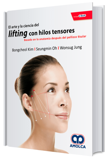 El Arte y la Ciencia del Lifting con Hilos Tensores. Basado en la Anatomía Después del Pellizco Tisular