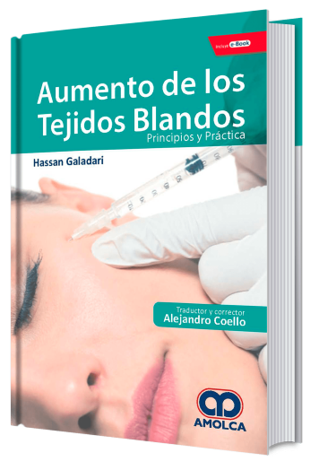 Aumento de los Tejidos Blandos. Principios y Práctica