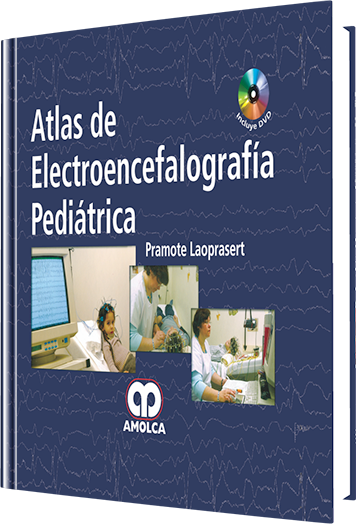 Atlas de Electroencefalografía Pediátrica