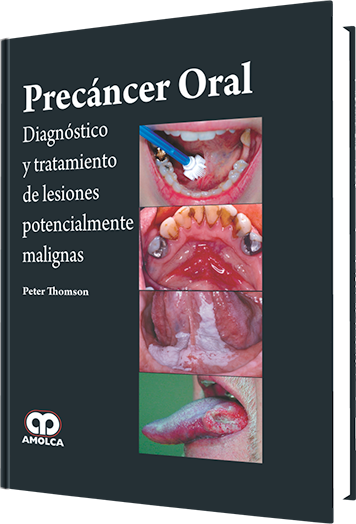 Precáncer Oral.  Diagnóstico y Tratamiento de Lesiones Potencialmente Malignas