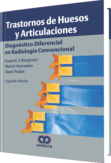 Trastornos de Huesos y Articulaciones. 2 Edición