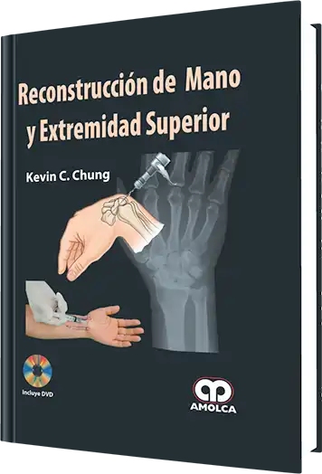 Reconstrucción de Mano y Extremidad Superior