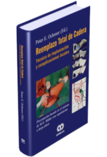 Reemplazo Total de Cadera