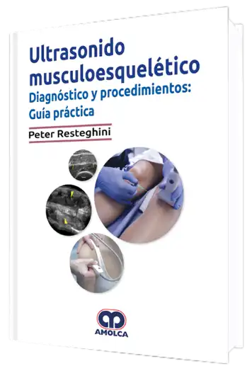 Ultrasonido Musculoesquelético Diagnóstico y Procedimientos. Guía Práctica