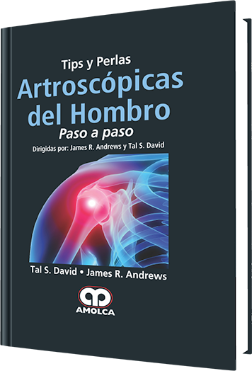 Tips y Perlas Artroscópicas del Hombro