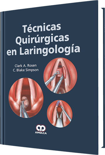Técnicas Quirúrgicas en Laringología