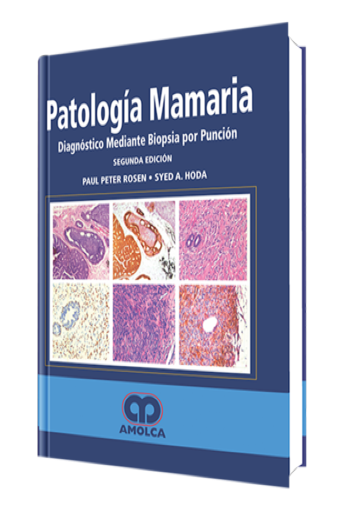 Patología Mamaria. Diagnóstico Mediante Biopsia por Punción 2 Edición
