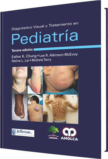 Diagnóstico visual y tratamiento en Pediatría.  3 edición