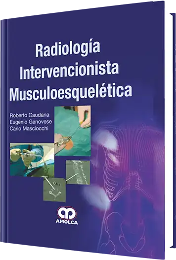 Radiología Intervencionista Musculoesquelética