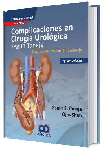 Complicaciones en Cirugía Urológica Según Taneja. Diagnóstico, Prevención y Manejo. 5 Edición