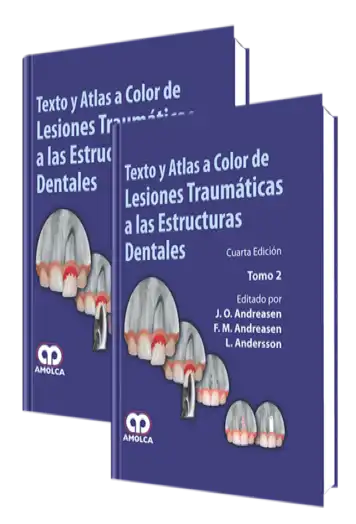Texto y Atlas a Color de Lesiones Traumáticas a las Estructuras Dentales. 4 edición
