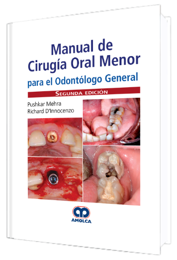 Manual de Cirugía Oral Menor para el Odontólogo General. 2 Edición