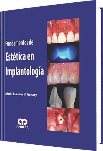 Fundamentos de Estética en Implantología