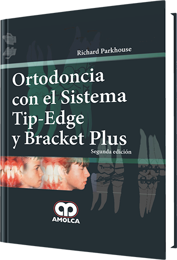 Ortodoncia con el Sistema Tip-Edge y Bracket Plus. 2 Edición