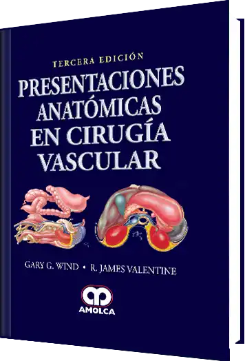 Presentaciones Anatómicas en Cirugía Vascular. 3 Edición
