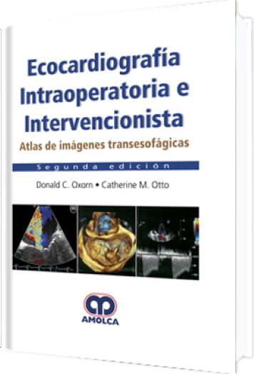 Ecocardiografía Intraoperatoria e Intervencionista 2 Edición