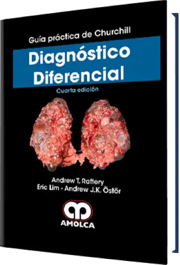 Guía práctica de Churchill Diagnóstico Diferencial. 4 Edición