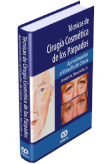 Técnicas de Cirugía Cosmética de los Párpados