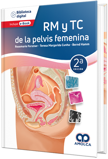 RM y TC de la pelvis femenina