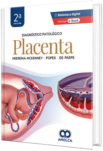 Diagnóstico patológico: Placenta. 2a Edición