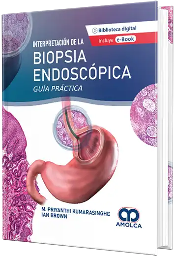 Interpretación de la Biopsia Endoscópica - Guía práctica