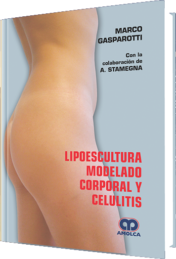 Lipoescultura, Modelado Corporal y Celulitis